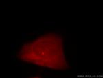 CEP170/CEP170L Antibody in Immunocytochemistry (ICC/IF)