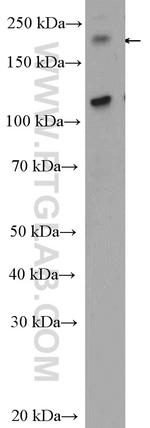 CEP170/CEP170L Antibody in Western Blot (WB)