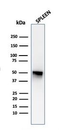 Thymidine Phosphorylase/PD-ECGF (Angiogenesis Marker) Antibody in Western Blot (WB)