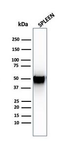 Thymidine Phosphorylase/PD-ECGF (Angiogenesis Marker) Antibody in Western Blot (WB)