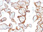 Thymidine Phosphorylase/PD-ECGF (Angiogenesis Marker) Antibody in Immunohistochemistry (Paraffin) (IHC (P))