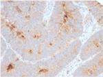 Secretory Component/ECM1 Recombinant Rabbit Monoclonal Antibody (ECM1, 2889R)