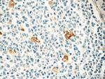 CLEC4D Antibody in Immunohistochemistry (Paraffin) (IHC (P))