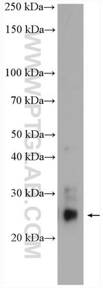 CLEC4D Antibody in Western Blot (WB)