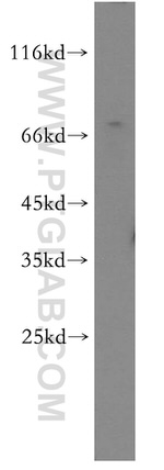 TULP1 Antibody in Western Blot (WB)