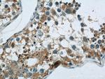 PAOX Antibody in Immunohistochemistry (Paraffin) (IHC (P))