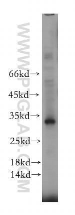 RTP1 Antibody in Western Blot (WB)