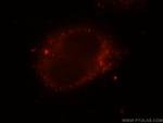 SH3PXD2A Antibody in Immunocytochemistry (ICC/IF)