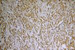 SH3PXD2A Antibody in Immunohistochemistry (Paraffin) (IHC (P))