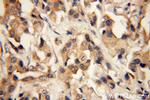 SH3PXD2A Antibody in Immunohistochemistry (Paraffin) (IHC (P))