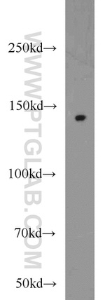 SH3PXD2A Antibody in Western Blot (WB)