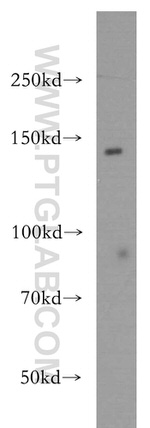 SH3PXD2A Antibody in Western Blot (WB)