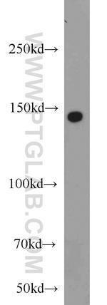 SH3PXD2A Antibody in Western Blot (WB)