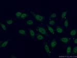 ZCCHC11 Antibody in Immunocytochemistry (ICC/IF)