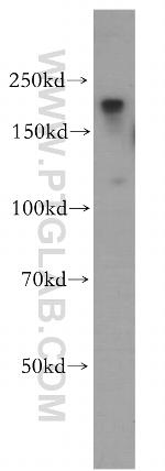 ZCCHC11 Antibody in Western Blot (WB)