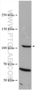 iNOS Antibody in Western Blot (WB)