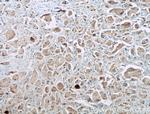 EGFR Antibody in Immunohistochemistry (Paraffin) (IHC (P))