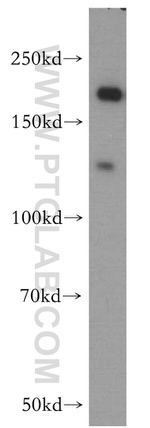 DOCK9 Antibody in Western Blot (WB)