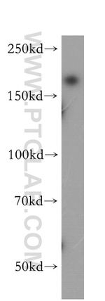 DOCK9 Antibody in Western Blot (WB)