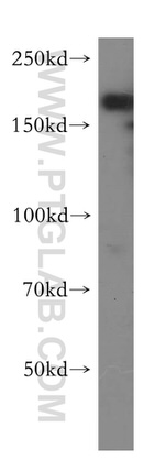 DOCK9 Antibody in Western Blot (WB)