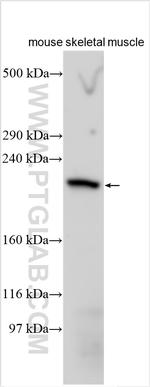 MYH8 Antibody in Western Blot (WB)