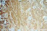 GLI2 Antibody in Immunohistochemistry (Paraffin) (IHC (P))