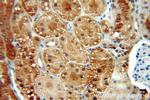 GLI2 Antibody in Immunohistochemistry (Paraffin) (IHC (P))