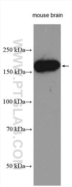 GLI2 Antibody in Western Blot (WB)