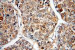 HAUS3 Antibody in Immunohistochemistry (Paraffin) (IHC (P))