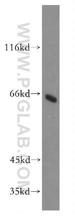 HAUS3 Antibody in Western Blot (WB)