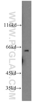 HAUS3 Antibody in Western Blot (WB)