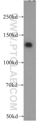 KIAA1468 Antibody in Western Blot (WB)