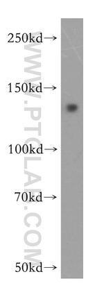 KIAA1468 Antibody in Western Blot (WB)