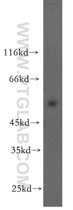 OCT2 Antibody in Western Blot (WB)