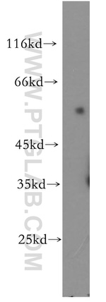 OCT2 Antibody in Western Blot (WB)