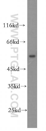 OCT2 Antibody in Western Blot (WB)