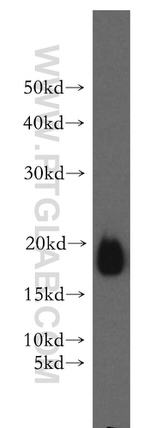 PTH Antibody in Western Blot (WB)