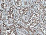 VEGF Antibody in Immunohistochemistry (Paraffin) (IHC (P))