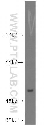 ZFP36L2 Antibody in Western Blot (WB)