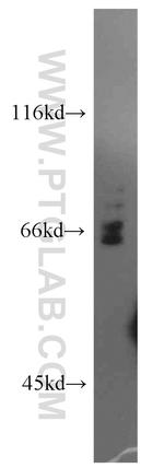 PIF1 Antibody in Western Blot (WB)