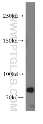 Brevican Antibody in Western Blot (WB)