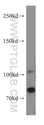 Brevican Antibody in Western Blot (WB)
