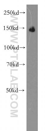 Brevican Antibody in Western Blot (WB)