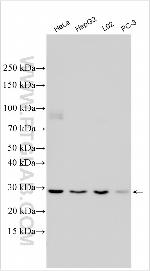 SNTB2 Antibody in Western Blot (WB)