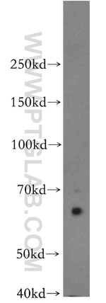 KLC1 Antibody in Western Blot (WB)
