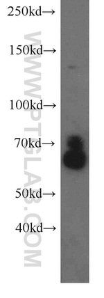 KLC1 Antibody in Western Blot (WB)