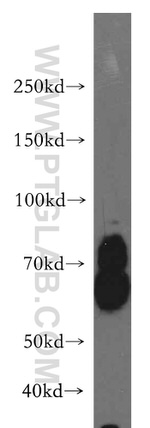 KLC1 Antibody in Western Blot (WB)