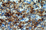 BAG1 Antibody in Immunohistochemistry (Paraffin) (IHC (P))