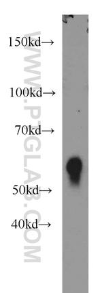 CD4 Antibody in Western Blot (WB)