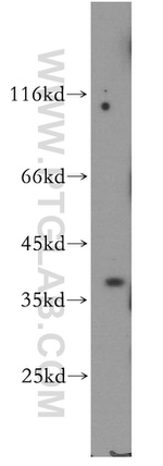 BRUNOL6 Antibody in Western Blot (WB)